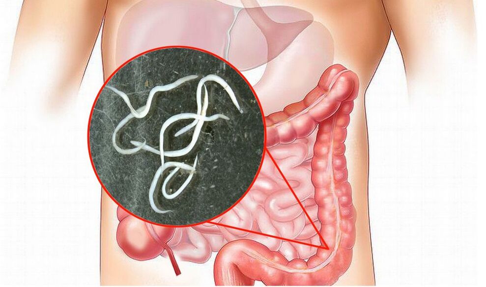 Parasitas no corpo humano sem tratamento