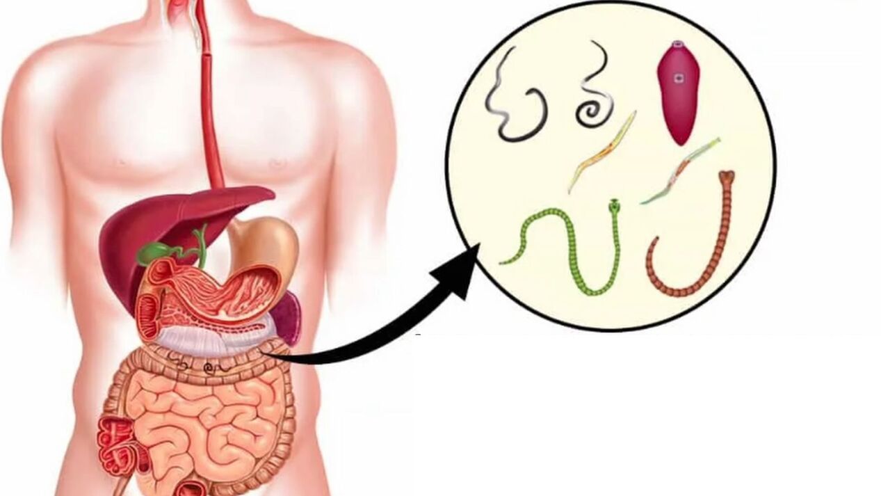 tipos de parasitas no corpo